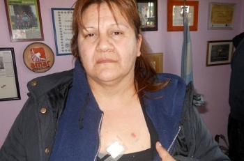 Imágenes de la represión en Tolhuin